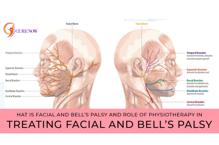 Bell's palsy physiotherapy